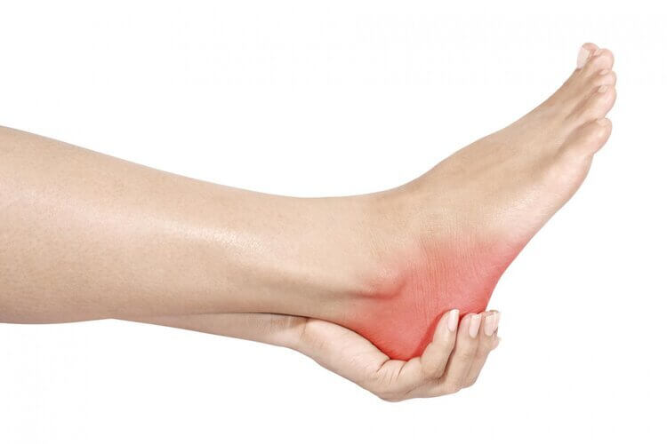 Types of Heel Pain - San Diego